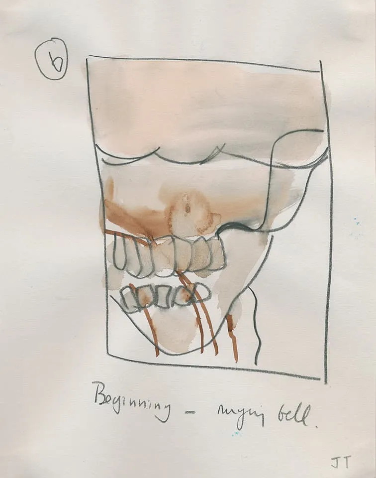 <strong>Drawings from neuroradiology department at Royal London Hospital 2000-06</strong>, Susan Aldworth. Installation at Transition Gallery, London, 2008.