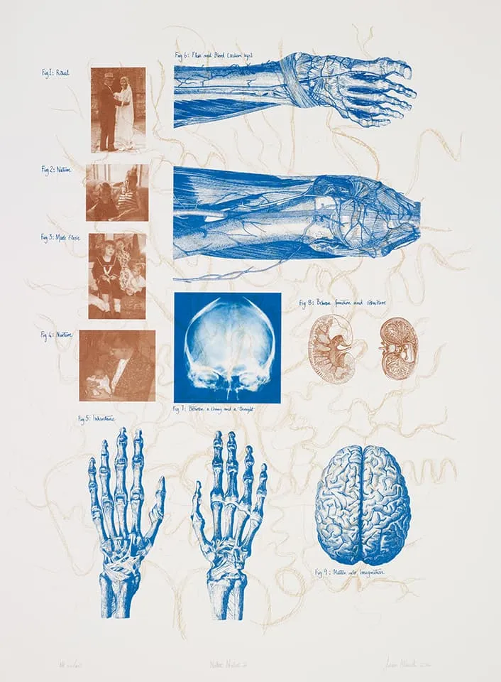 <strong>Nature Nurture 2</strong>, Susan Aldworth, lithograph, 77 x 60 cms, 2012. Photograph&nbsp;by&nbsp;Anna&nbsp;Arca.