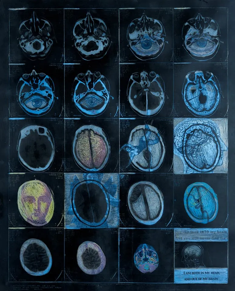<strong>Cogito Ergo Sum 1</strong>, Susan Aldworth, mixed media, 43 x 35 cms, 2002. Photograph by Peter Abrahams.