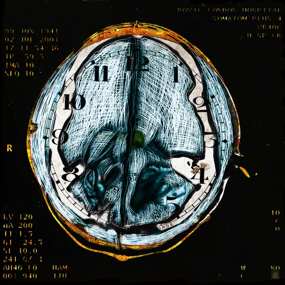 <strong>Cogito Ergo Sum 3.12</strong>, Susan Aldworth, archival digital print, 35 x 35 cms, 2006.
