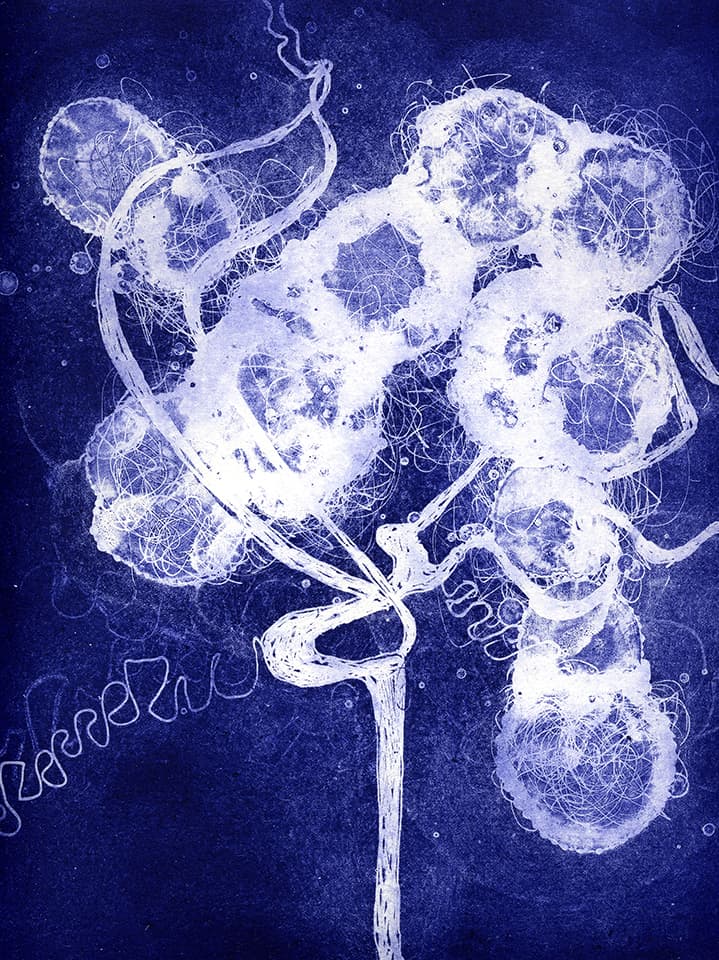 <strong>Brainscape 17</strong>, Susan Aldworth, aquatint and etching, 30 x 25 cms, 2005.