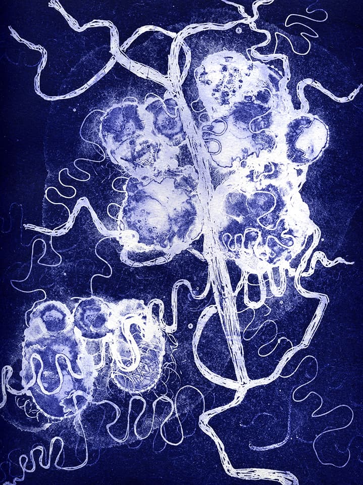<strong>Brainscape 18</strong>, Susan Aldworth, aquatint and etching, 30 x 25 cms, 2005.