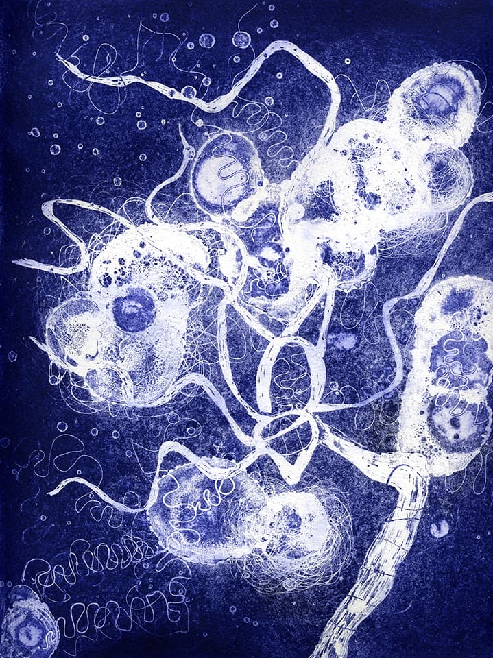 <strong>Brainscape 21</strong>, Susan Aldworth, aquatint and etching, 30 x 25 cms, 2005.