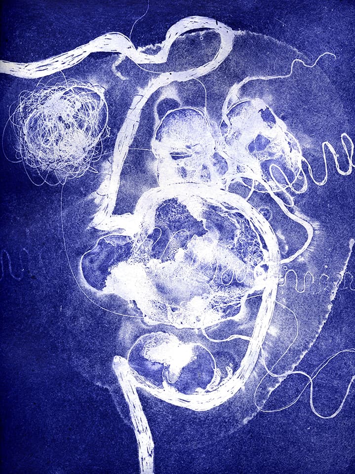 <strong>Brainscape 23</strong>, Susan Aldworth, aquatint and etching, 30 x 25 cms, 2005.